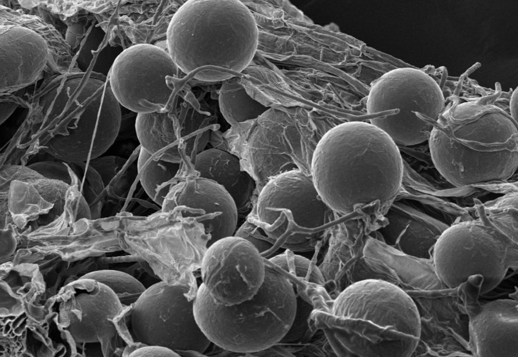 arbuscular mycorrhizal fungi (AMF) spores